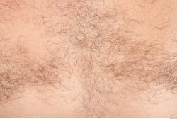 Hairy Skins